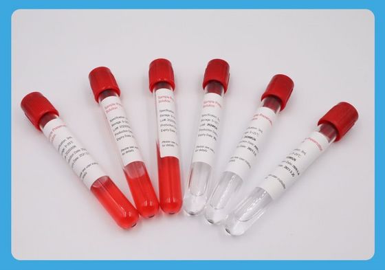 spezielles Beispielsammlungs-Rohr-Ethylenoxid des Faden-5ml