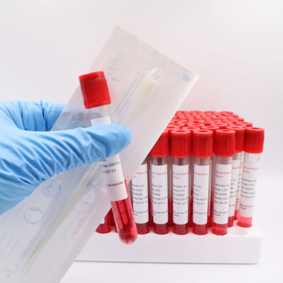 Blut-Sammlungs-Rohr-Wegwerfvirus 1.5ml 2ml