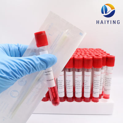 Beispielsammlung des Blut-10ml füllt Virus-Grippe-Test ab