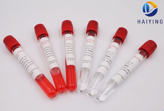 Nukleinsäure-Blut-Exemplar-Rohr-Labor
